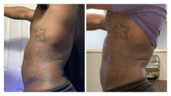 Fat Burning Cream and Serum | TheNewYouSquad